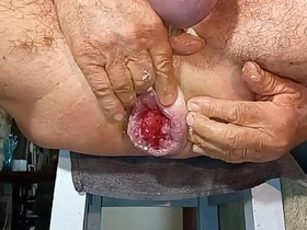 Gapingman 2025-14 asian young boy gay sex videos