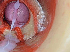 Female Insemination - Internal Camera Captures Deep Male Illustrious Ejaculation gay sex videos asian xvideos