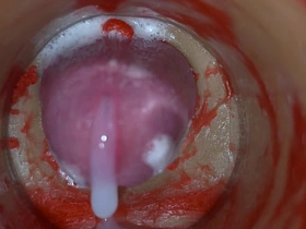 Insemination - Internal Camera Captures Deep Male Except asian gay bottom sex videos